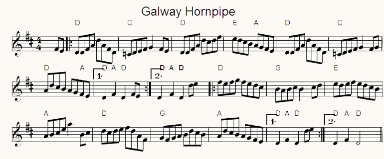 Galway Hornpipe